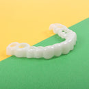 Facetas Removíveis Odontológicas – Snap On Smile para um Sorriso Perfeito Instantaneamente
