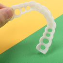 Facetas Removíveis Odontológicas – Snap On Smile para um Sorriso Perfeito Instantaneamente